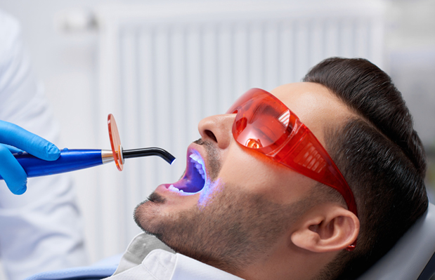 What Are Dental Fillings