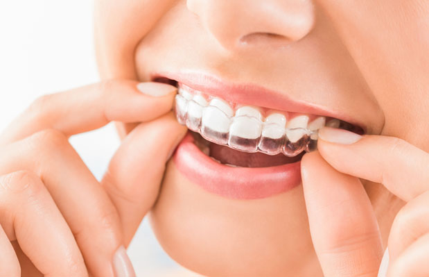 Invisalign Treatment Vacaville